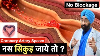 Understand Chest Pain by Coronary artery Spasm  दील की नस सिकुड़ जाये तोDrEducation [upl. by Ennayelhsa]