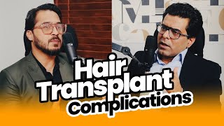 Hair Transplant Complications  Sajid Hassan hairtransplant  AlKhaleej Podcast [upl. by Tersina]