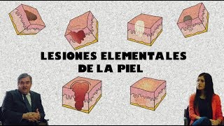 Lesiones Elementales de la Piel [upl. by Chapland]