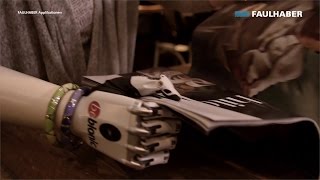 Medical amp Lab Equipment  Prosthetics bebionic [upl. by Nnayr]