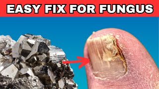 This Rare Mineral Cures Toenail Fungus [upl. by Jamison]