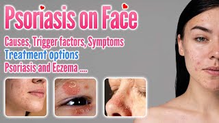 Psoriasis on Face Causes Symptoms Trigger Factors Types Contagiosity and treatment options [upl. by Gautea891]