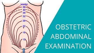 Obstetric Abdominal Examination  Steps for examining a pregnant woman [upl. by Ullund]