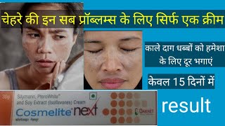 चेहरे के काले दाग धब्बों के लिए बेस्ट क्रीमcosmelite next cream review usesdosageside effects [upl. by Nairbal]