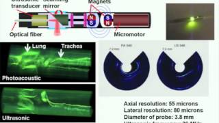 Photoacoustic tomography ultrasonically breaking through the optical diffusion limit [upl. by Anrat975]