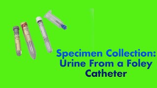 Specimen Collection Urine from a Foley Catheter [upl. by Held490]