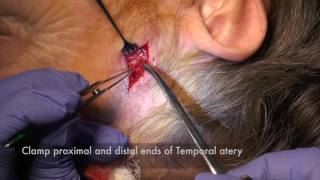 Temporal Artery Biopsy [upl. by Onid609]