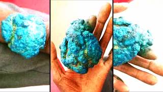 Blue Cysts Must Watch Viral Video [upl. by Brindell416]