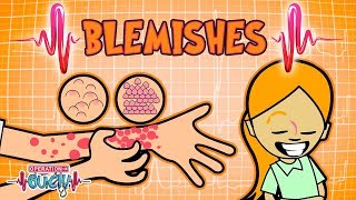 Science for kids  Body Parts  BLEMISHES  Experiments for kids  Operation Ouch [upl. by Clay]