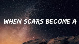 When Scars Become Art [upl. by Attehcnoc]