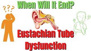 Eustachian Tube Dysfunction When Will It End My Personal Experience [upl. by Goraud]