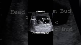 8 Weeks Ultrasound jerbearimaging 8weeks pregnant firsttrimester sono ultrasound [upl. by Ainig]