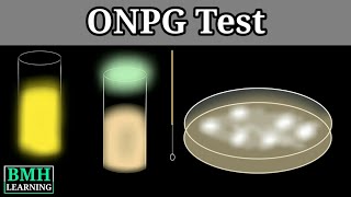 ONPG Test  Betagalactosidase ONPG Activity Assay [upl. by Ayik]