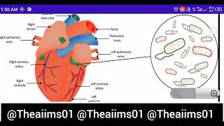 Endocarditis Cardiovascular diseasesdisorders [upl. by Danuloff]