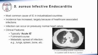 Endocarditis Microbiology and Treatment [upl. by Ardnuasal]