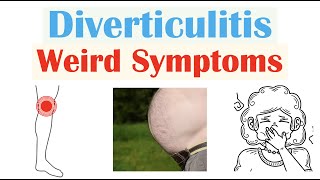 Weird Symptoms of Diverticulitis  Atypical Clinical Features of Diverticulitis [upl. by Pepper]