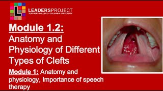 Module 12 Cleft Palate Speech and Feeding Anatomy and Physiology of Cleft Lip and Palate [upl. by Jacqui417]