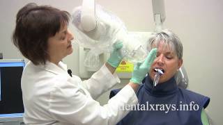 How to take dental xrays with bisecting angle positioning [upl. by Seaddon]