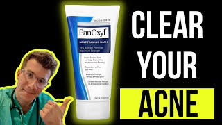 Doctor explains how to use BENZOYL PEROXIDE for ACNE aka PanOxyl  Acnecide  Side effects amp more [upl. by Auohs]