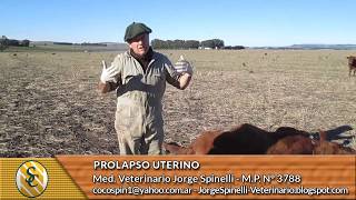 Dr Jorge Spinelli  Prolapso Uterino [upl. by Atilol]