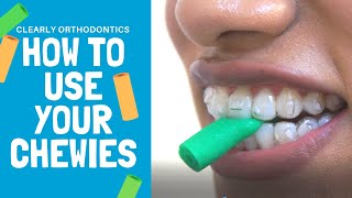 How to use Chewies  Invisalign Treatment [upl. by Wojcik]