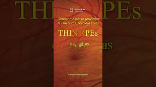 Choroidal Folds THIN RPEs Mnemonic rule to remember 8 causes [upl. by Launame694]