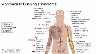 Approach to Cushings syndrome [upl. by Eam]