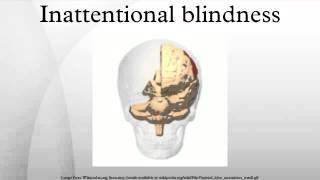 Inattentional blindness [upl. by Malik]