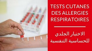 Tests cutanés des allergies respiratoires │ الاختبار الجلدي للحساسية التنفسية [upl. by Sasnak]