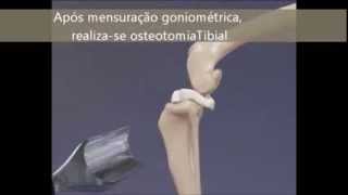 Técnicas de Tratamento da Ruptura do Ligamento Cruzado Cranial [upl. by Aynat]