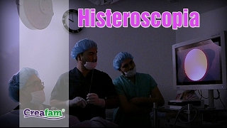 Histeroscopia con el Dr Otto Paredes [upl. by Beane]