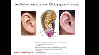 53 Puntos de auriculoterapia en lóbulo unido a la cabeza Centro IMG [upl. by Nohsar]