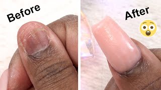 MY Real Nail Came OFF  Heres How I Fixed It [upl. by Aleet]