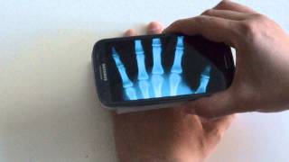 Xray Scan Android Review [upl. by Virgin]