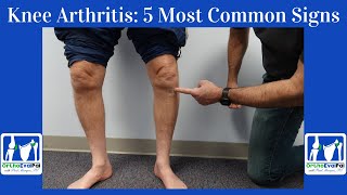 Knee Arthritis 5 Most Common Signs You Have It [upl. by Rolat10]