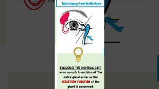 lacrimal apparatus anatomy ophthalmology [upl. by Ecirual]