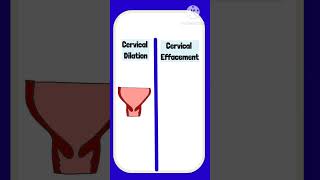 Cervical Dilation vs Cervical Effacement pregnancy cervix labour obstetrics [upl. by Hoo]