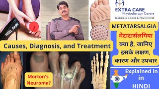 Metatarsalgia  Causes Diagnosis and Treatment  पंजों में दर्द  Mortons Neuroma  in HINDI [upl. by Cockburn83]