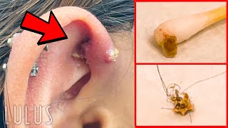 CLEAN Your Piercings Or THIS Can Happen…REMOVAL [upl. by Tobye]