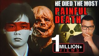 वो अपने मरे शरीर में 83 Days तक तड़पता रहा The Most Painful and Scary Story of Hisashi Ouchi [upl. by Rekrap]