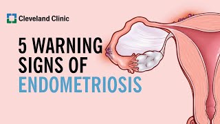 5 Warning Signs of Endometriosis [upl. by Eunice]