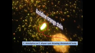 Acidine orange stained slide of chromatoid body of E histolytica or dispar [upl. by Abil]