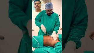 Gynaecomastia Surgery youtubeshorts trending youtubevideos short [upl. by Edmanda168]