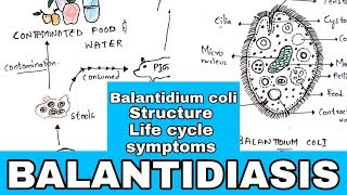 Balantidiasis  Balantidium coli Structure Life cycle Symptoms Medication  Bio science [upl. by Hehre15]