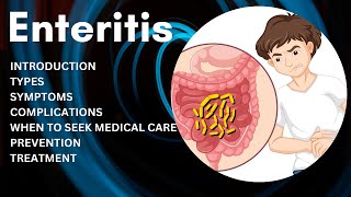 What is Enteritis  Enteritis Prevention and Treatment [upl. by Oster]