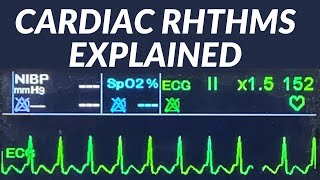 ECG Interpretation  AtrioVentricular Block [upl. by Drewett]