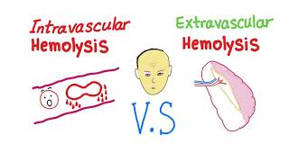 Intravascular Vs Extravascular Hemolytic Anemia Whats The ACTUAL Difference [upl. by Aikat914]