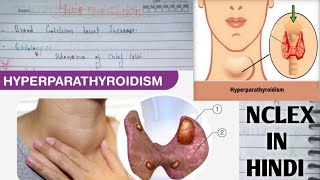 Hyperparathyroidism Nursing Symptoms Pathophysiology NCLEX  Parathyroid Hormone Gland Disorders [upl. by Epner]