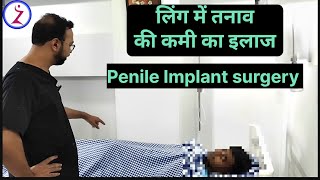 Penile Implant In Mumbai Bangalore Hyderabad Kolkata Lucknow Surat Ahmedabad Bhopal Jaipur Jodhpur [upl. by Aggappe]