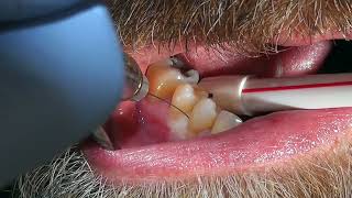 Easy Tooth Extraction  Dental Minute with Steven T Cutbirth DDS [upl. by Ahsenac]